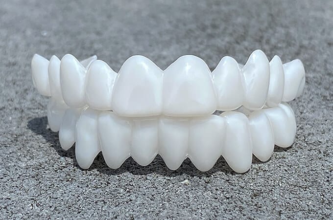 VitaSmile Dental Veneers For Natural Fit And Comfort