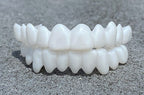 VitaSmile Dental Veneers For Natural Fit And Comfort