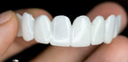 VitaSmile Dental Veneers For Natural Fit And Comfort