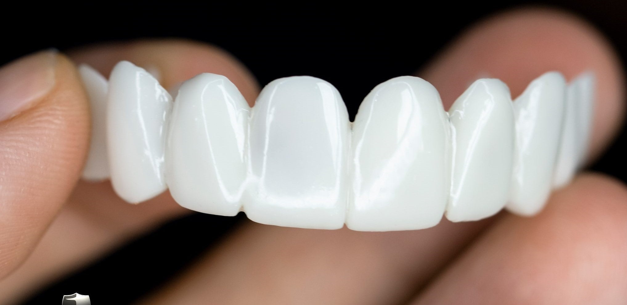 VitaSmile Dental Veneers For Natural Fit And Comfort