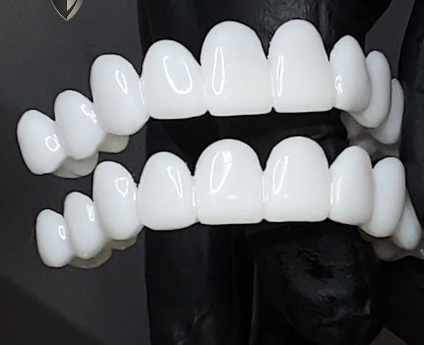 VitaSmile Dental Veneers For Natural Fit And Comfort