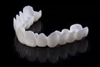 VitaSmile Dental Veneers For Natural Fit And Comfort