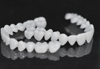VitaSmile Dental Veneers For Natural Fit And Comfort