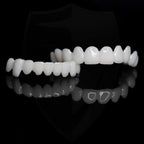 VitaSmile Dental Veneers For Natural Fit And Comfort