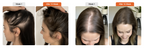 Korea's #1 Hair Growth Serum