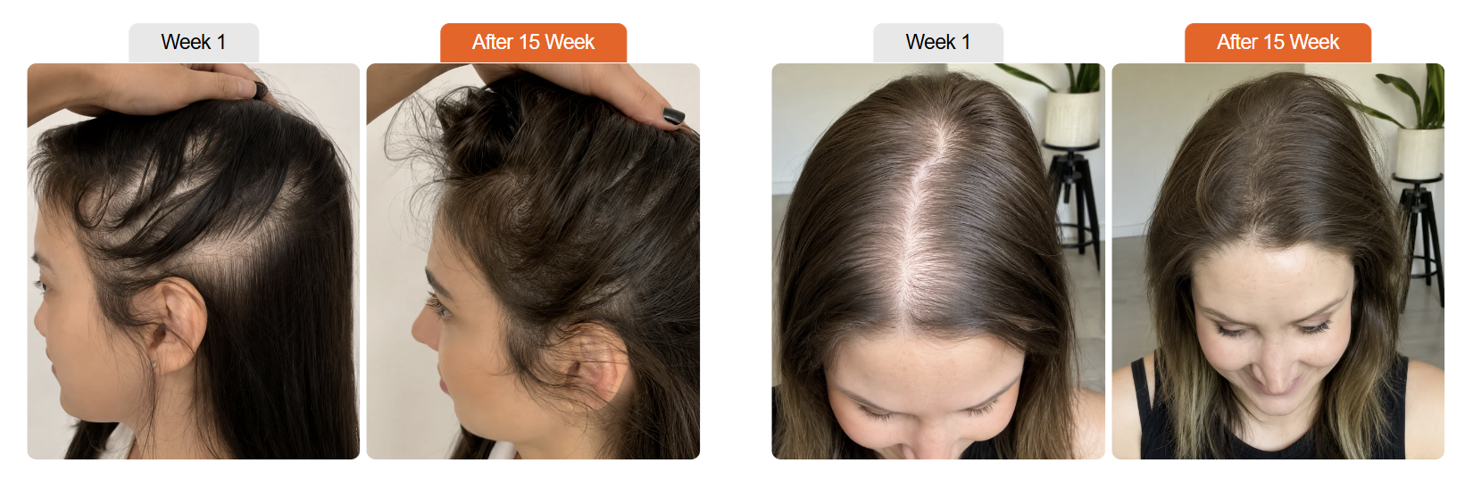 Korea's #1 Hair Growth Serum